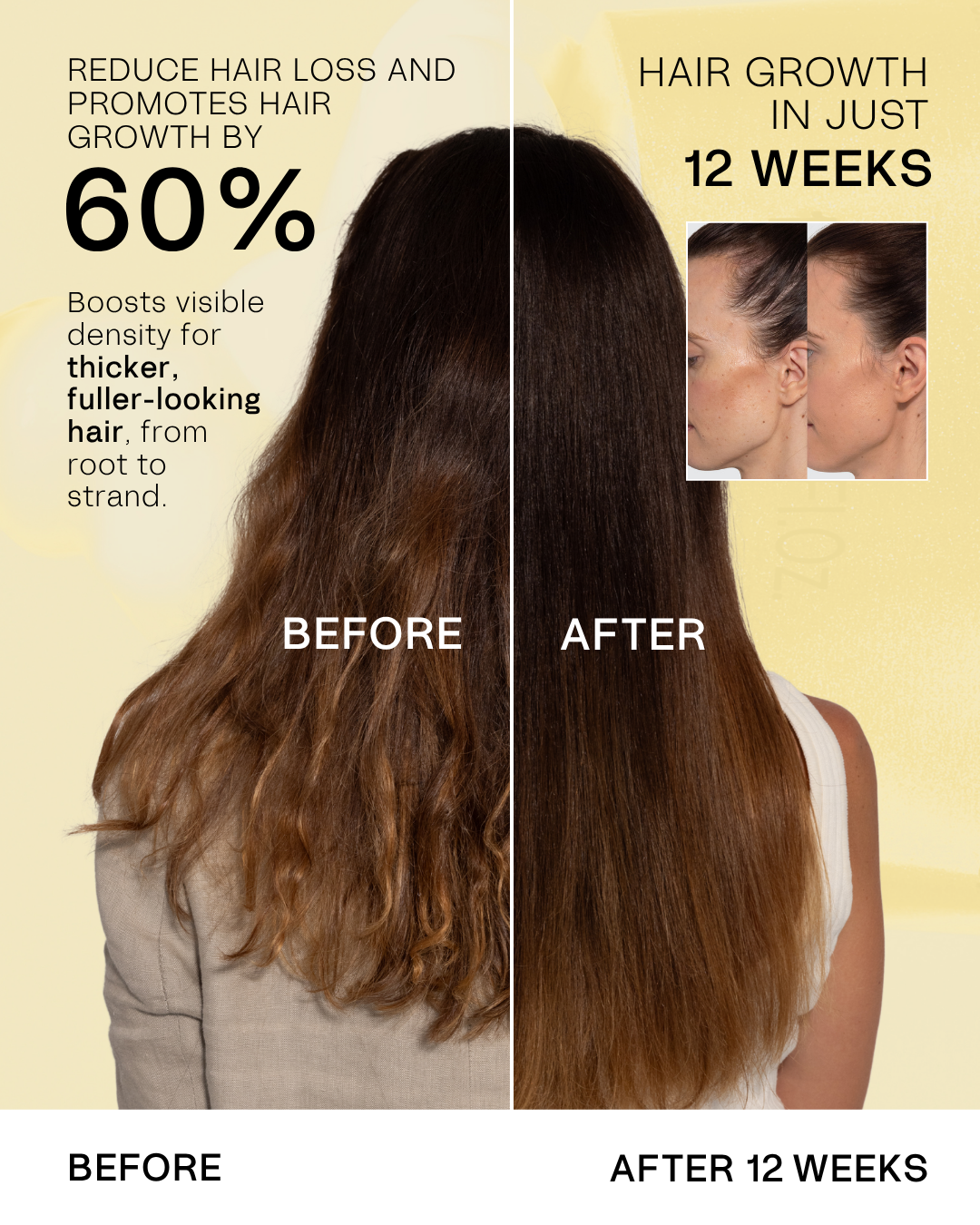 TYPEBEA Hair Growth & Gloss Kit: before and after hair growth results